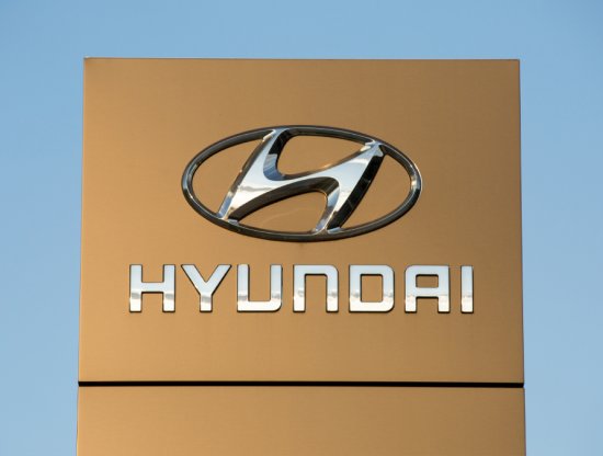 Hyundai X'te Reklam Vermeyi Durdurdu: Nedeni Herkesi Şok Ediyor!